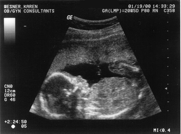 ultrasoundlarge.jpg - 48402 Bytes